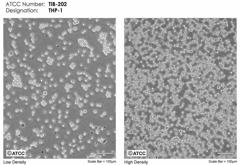 ATCC细胞库THP-1细胞图片
