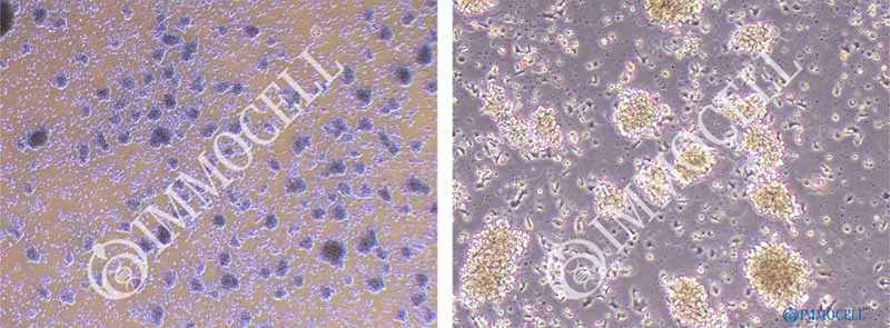 NK细胞形态图片