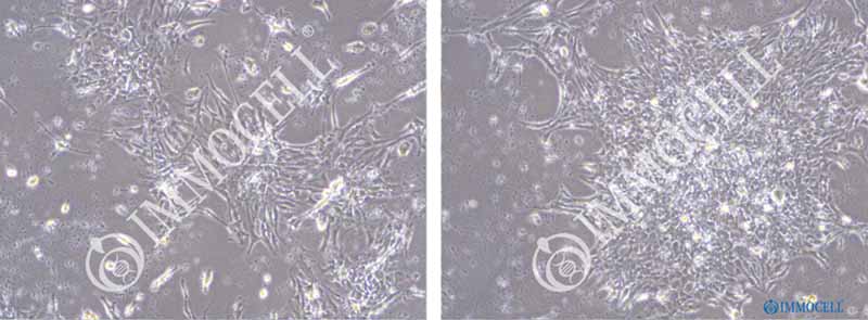 小鼠神经星形胶质细胞传代培养图片