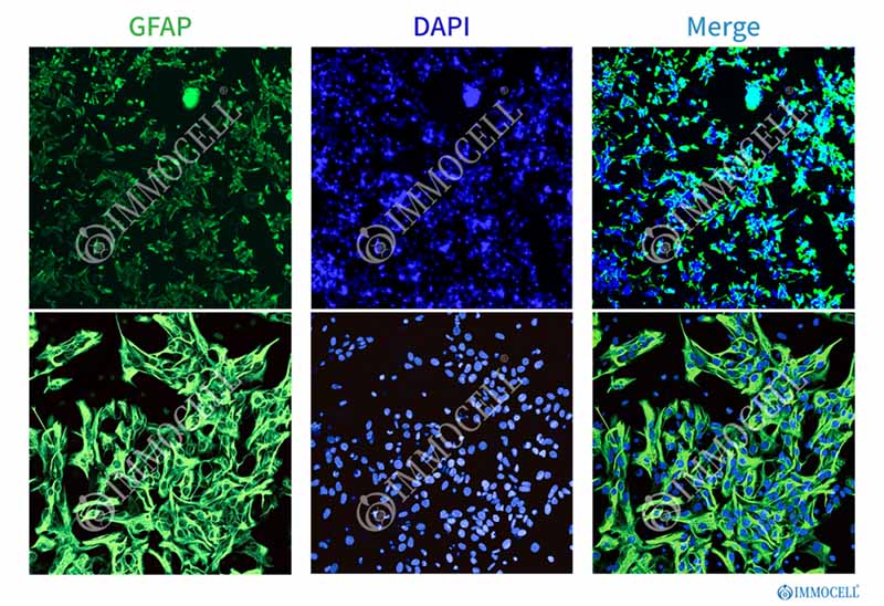 小鼠神经星形胶质细胞经GFAP免疫荧光鉴定图片