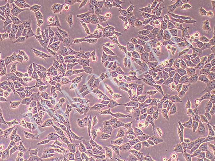 GIST-T1 人胃肠道间质瘤细胞（STR鉴定报告）图片