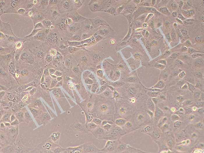 KURAMOCHI 人卵巢癌细胞（STR鉴定报告）图片