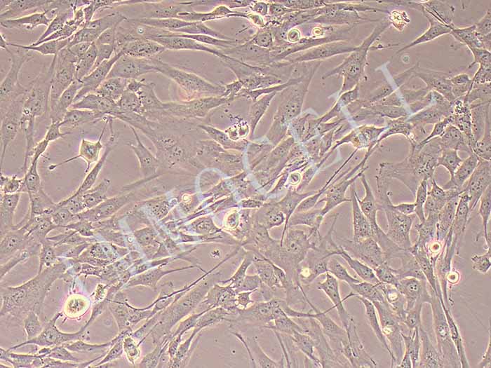 人支气管平滑肌细胞永生化（免疫荧光鉴定）图片