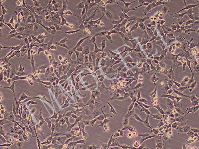 F81猫肾细胞（种属鉴定报告）图片