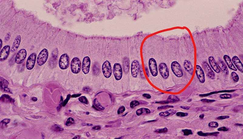 柱状上皮细胞图