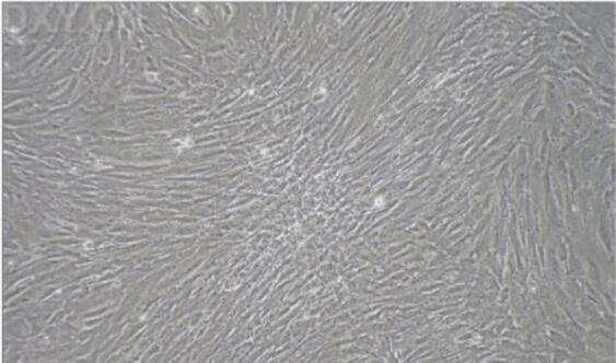 左: 小鼠成纤维细胞；右:鸡胚成纤维细胞图片