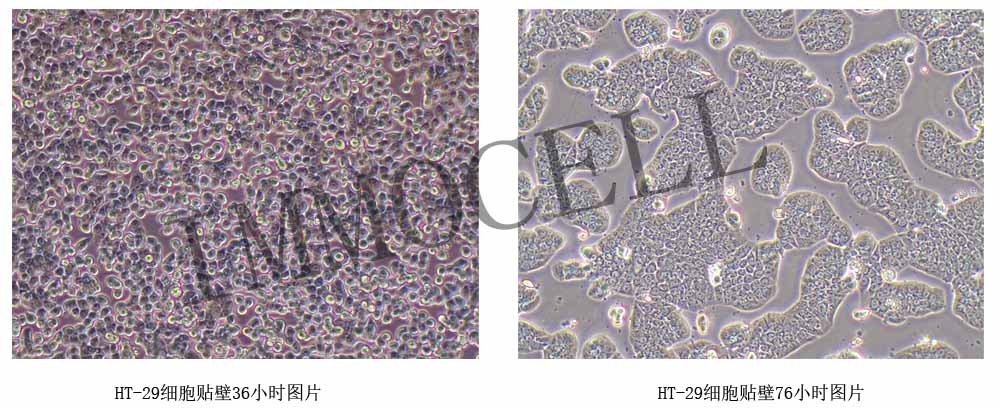 HT-29细胞形态图