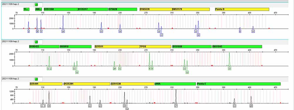 Hep G2.2.15人肝癌细胞.jpg