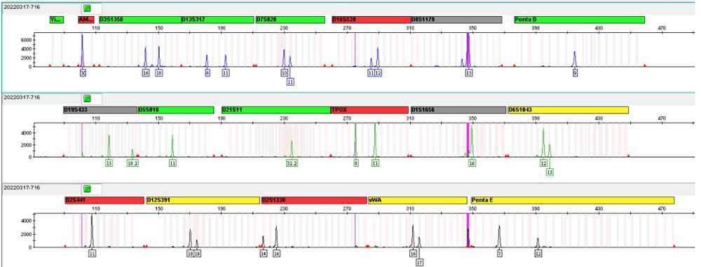 NCI-H716人结直肠腺癌细胞.jpg