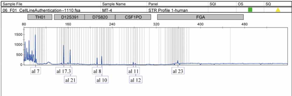 MT-4人急性淋巴母细胞白血病细胞.jpg