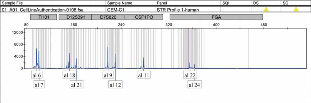 CEMC1人急性淋巴细胞白血病细胞.jpg