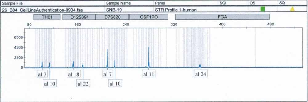 SNB-19人胶质瘤细胞.jpg