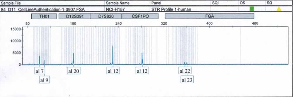 NCI-H157人非小细胞肺腺癌细胞.jpg