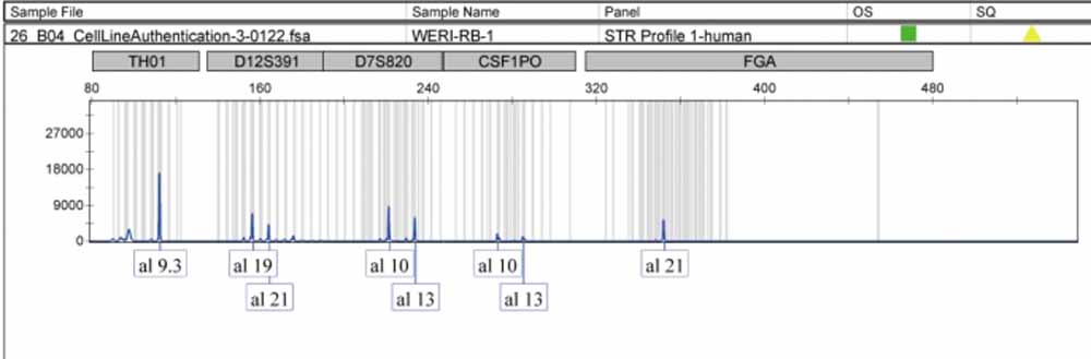WERI-RB-1人视网膜神经胶质瘤细胞.jpg