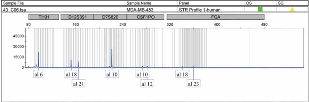 MDA-MB-453人乳腺癌细胞.jpg