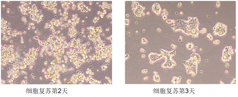 NK92细胞复苏图片