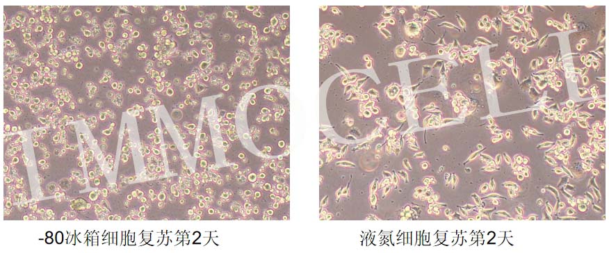 L929小鼠成纤维细胞复苏图