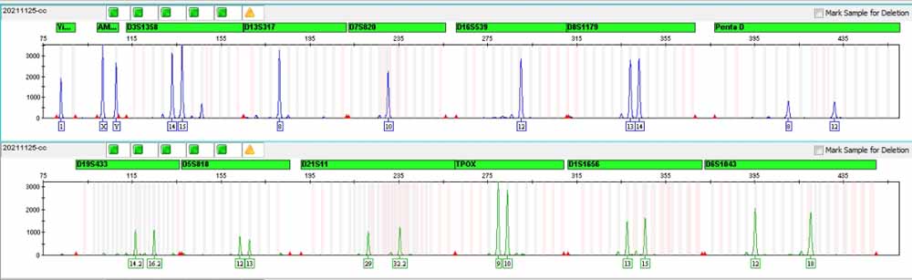CCC-HPF-1人胚肺成纤维细胞.jpg