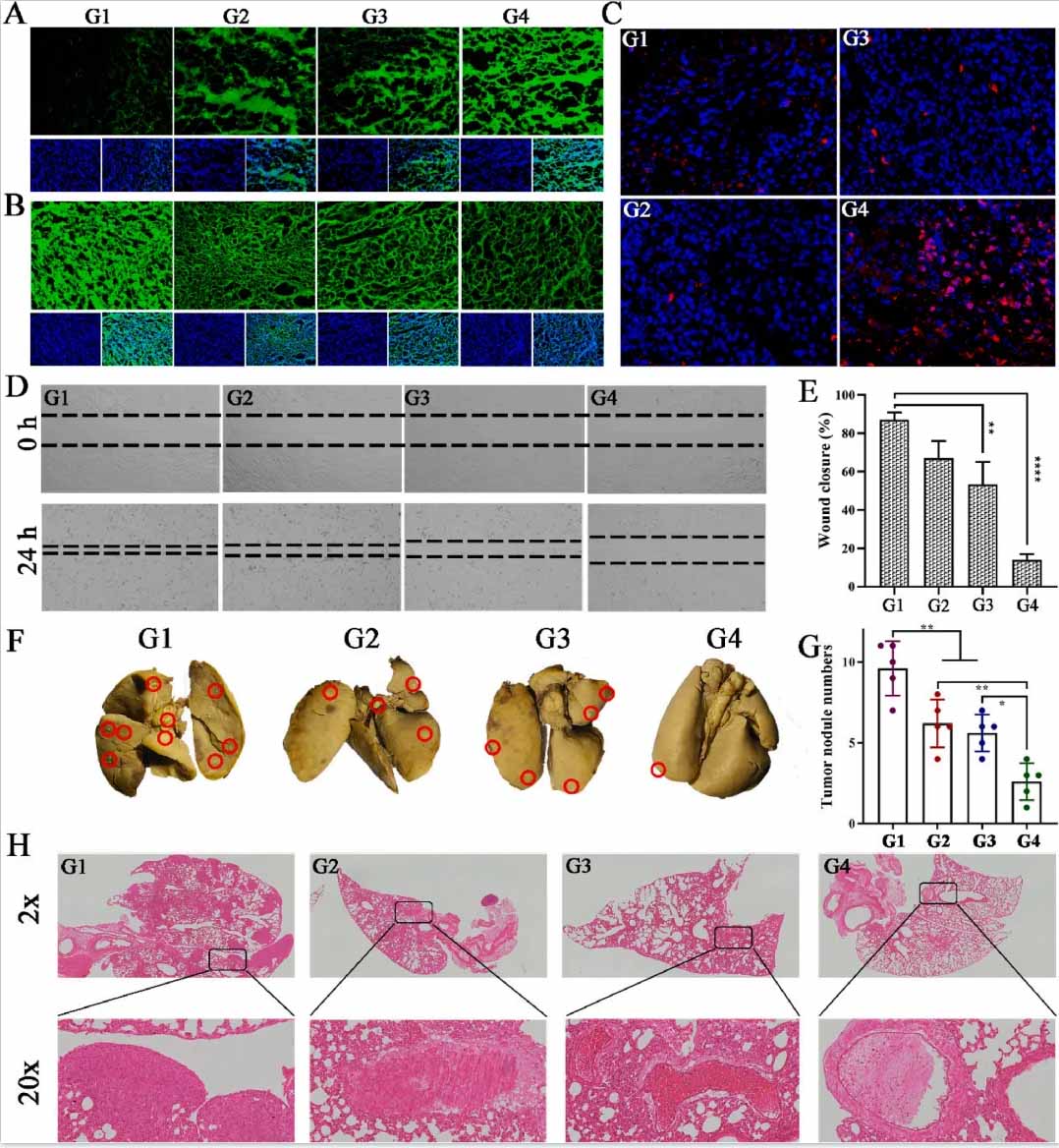 治疗后肿瘤切片的ROS生成、GSH水平和Caspase-3免疫荧光图像。