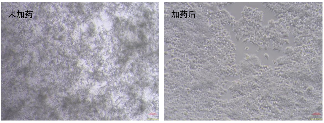 真菌清除剂产品效果图1