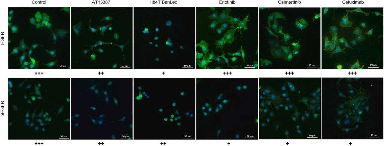 图6：免疫荧光法确认 EGFR 稳态和 EGFR 磷酸化