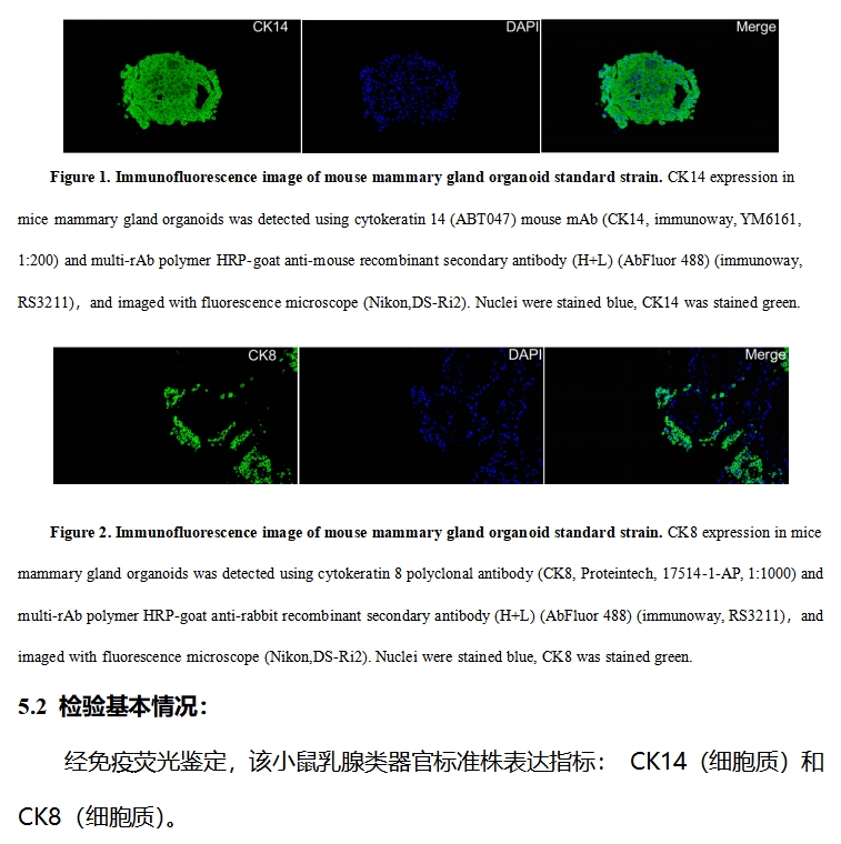 小鼠乳腺类器官标准株免疫荧光鉴定.png