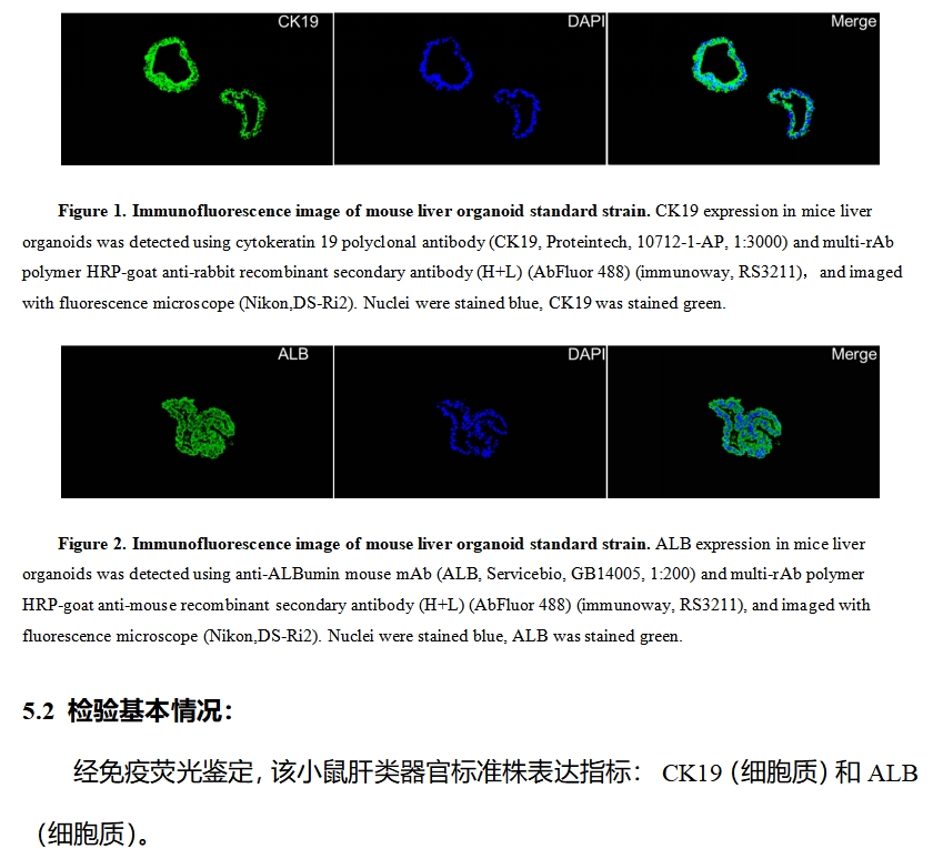 小鼠肝类器官标准株免疫荧光鉴定图.png