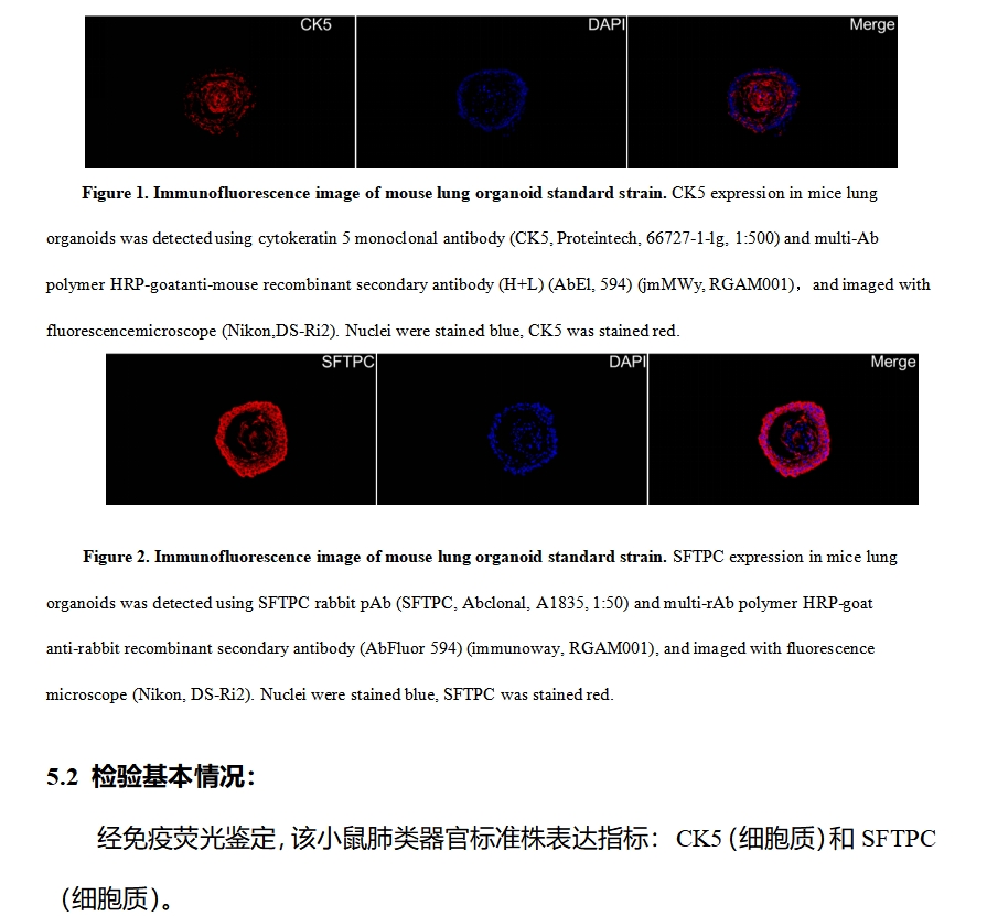 小鼠肺类器官标准株免疫荧光鉴定.png