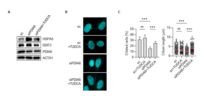 Figure 3：缓解内质网应激可恢复 PDIA6 缺失细胞的纤毛生成