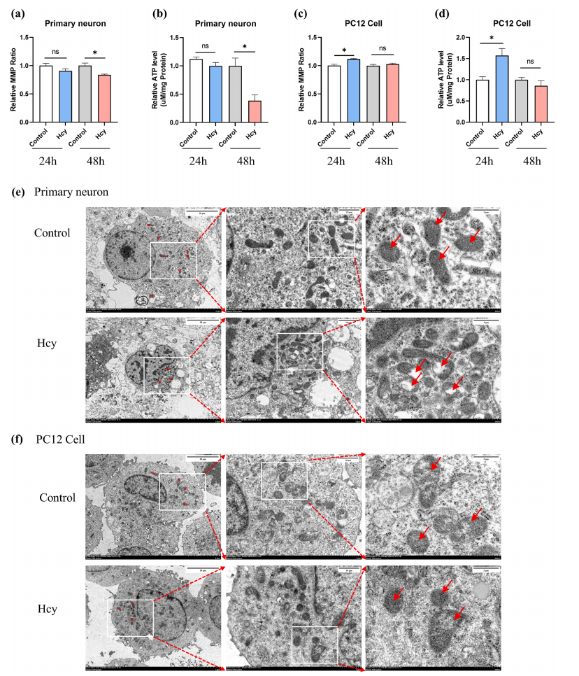Fig.1：Hcy 对线粒体结构与功能的细胞特异性影响