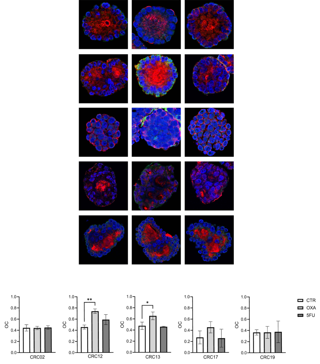 图2,钙网蛋白暴露分析。