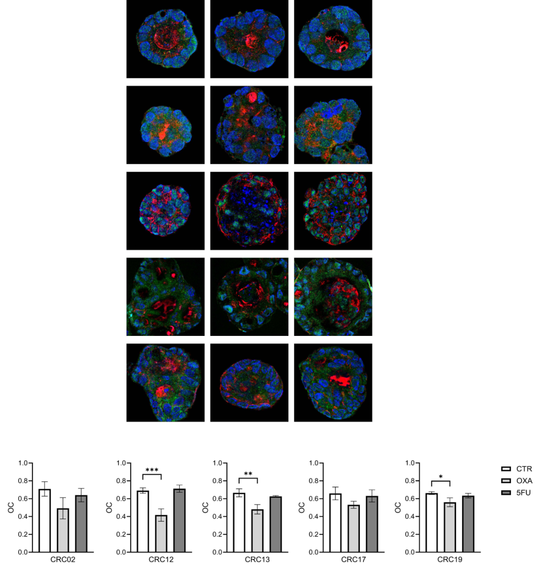 图4,HMGB1释放分析。