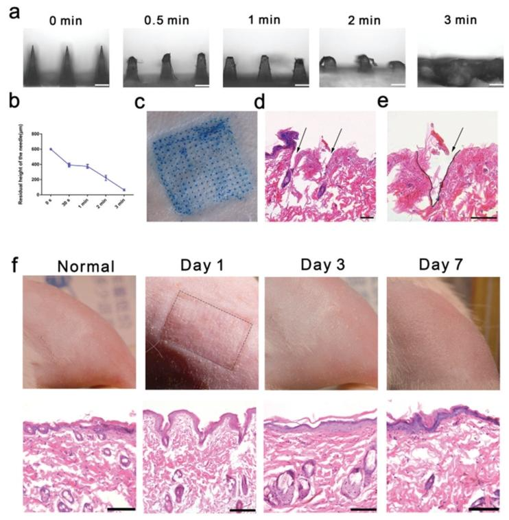图3：微针溶解动力学、插入性与生物相容性