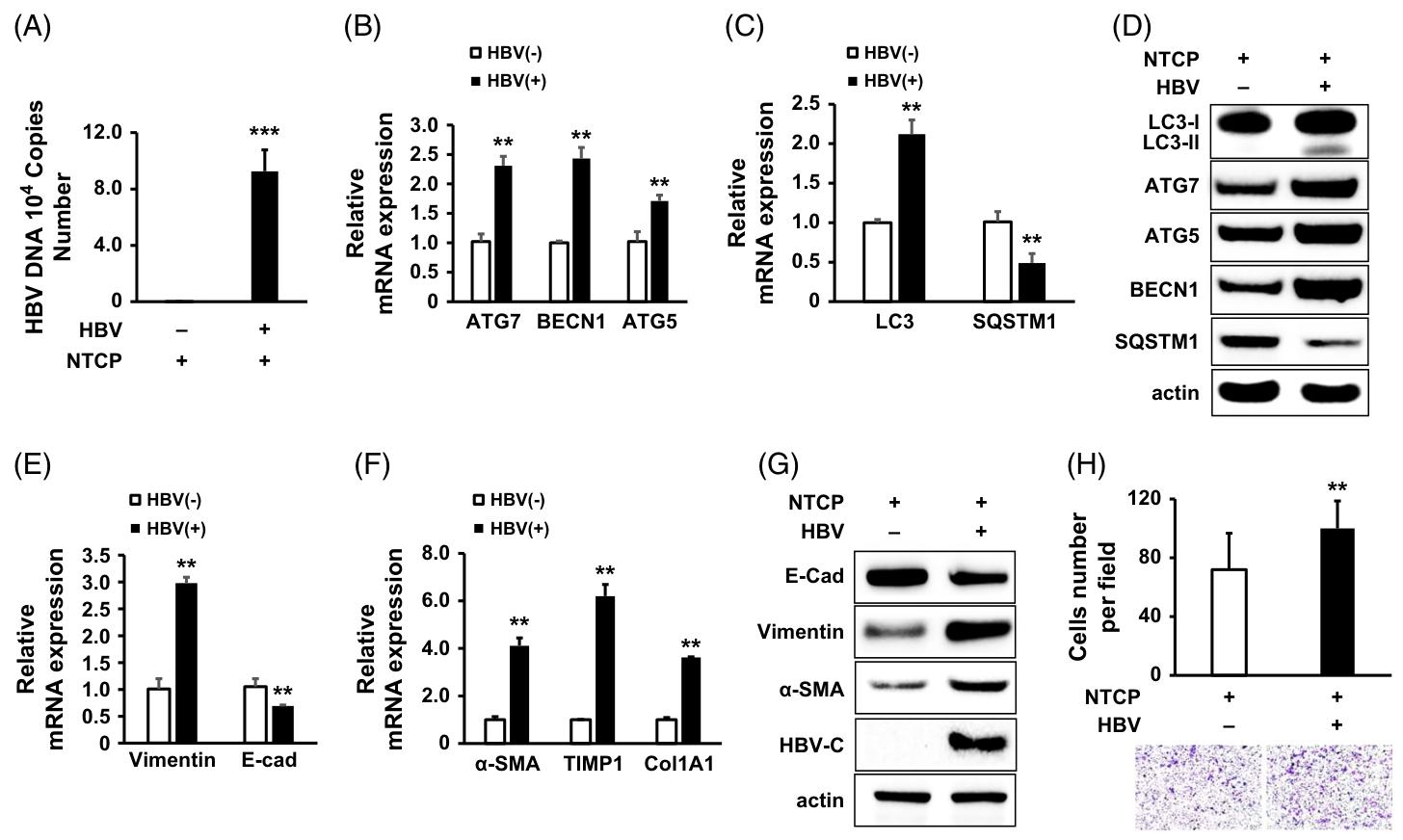 图2：HBV 感染促进 Huh7.5.1-NTCP 细胞的自噬、肝纤维化和 EMT