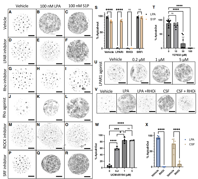 图3，GPCR/RhoA信号通路机制