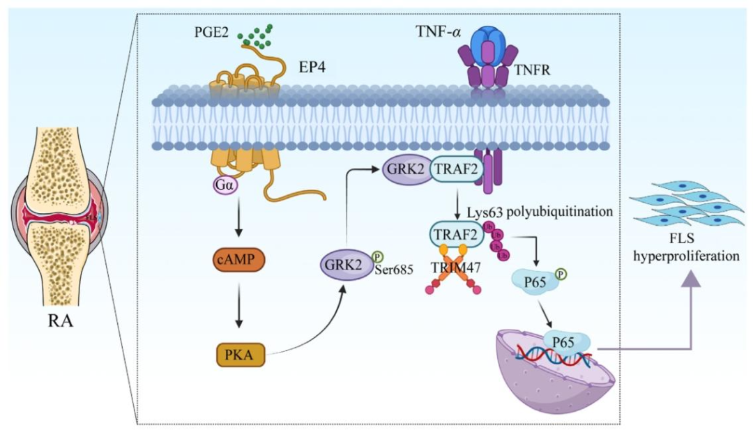 图 8：GRK2-TRAF2-NF-κB 通路调控 RA-FLS 增殖的机制示意图