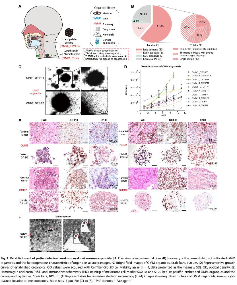 图1 建立患者来源的口腔黏膜黑色素瘤类器官
