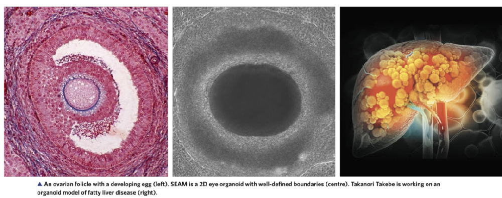 图像右侧显示了武部正在研究的脂肪肝疾病的类器官模型。