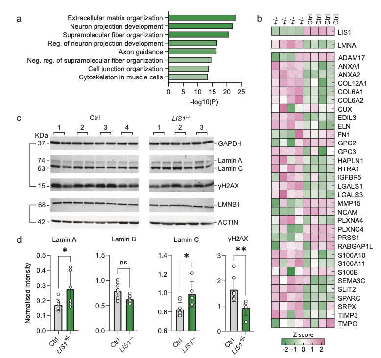图2 蛋白质组学分析