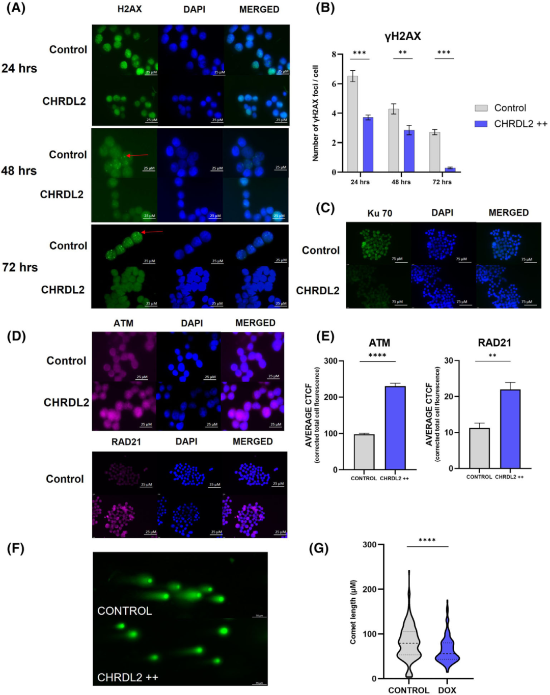 图3研究了CHRDL2过表达对化疗药物处理期间DNA损伤和修复的影响。