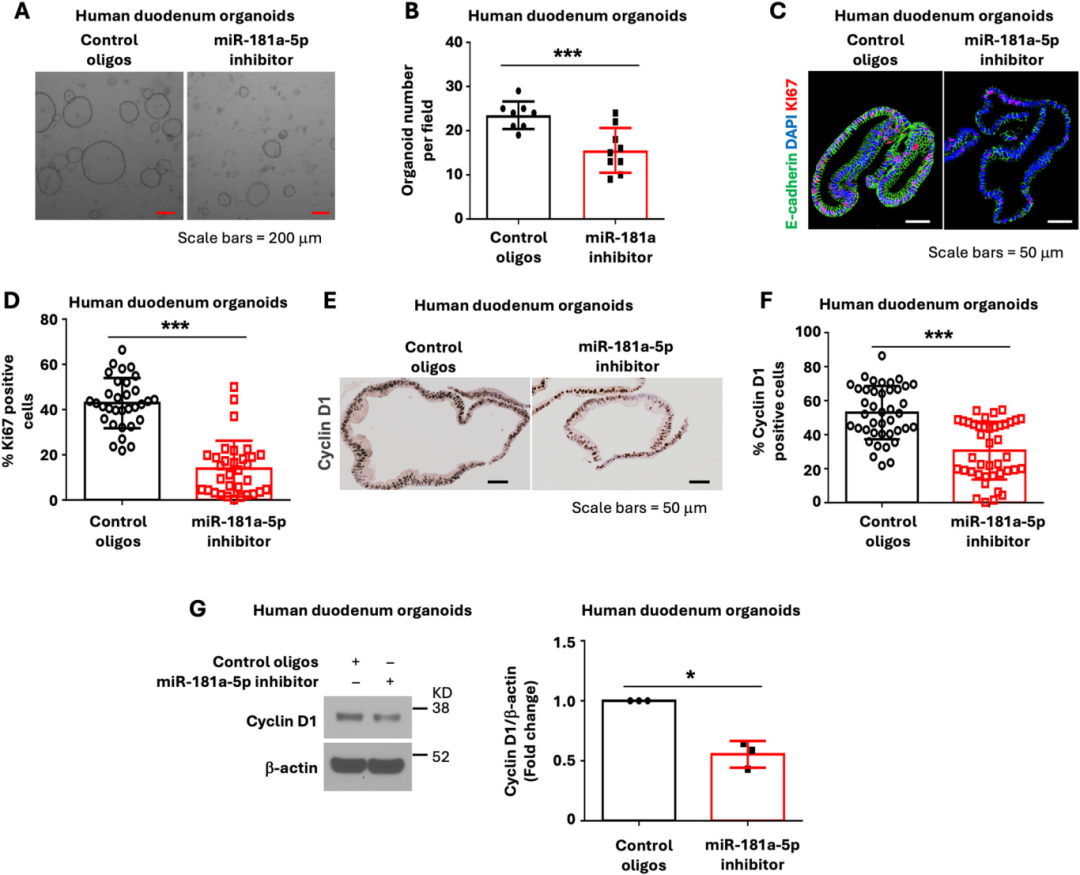 图6体现，人类十二指肠类器官经LNA miR-181a-5p抑制剂处理，类器官形成能力下降