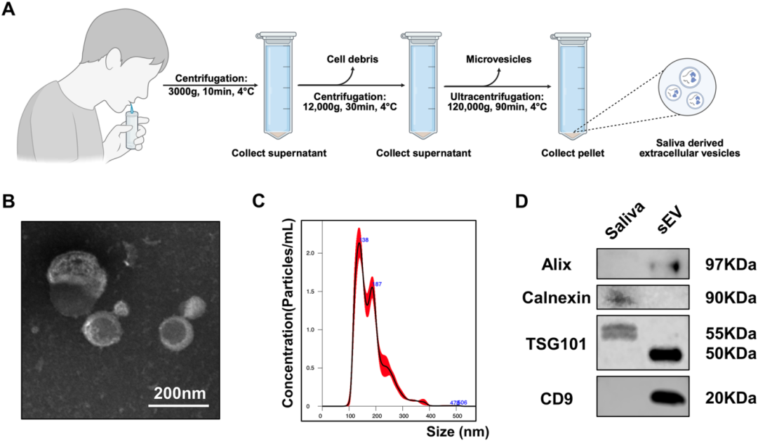 图2展示了唾液源性细胞外囊泡(sEV)的分离和鉴定过程。