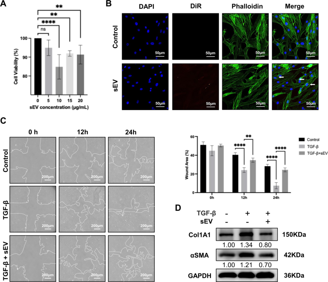 图3评估了sEV对人唾液腺成纤维细胞(hSGFs)纤维化活性的影响。