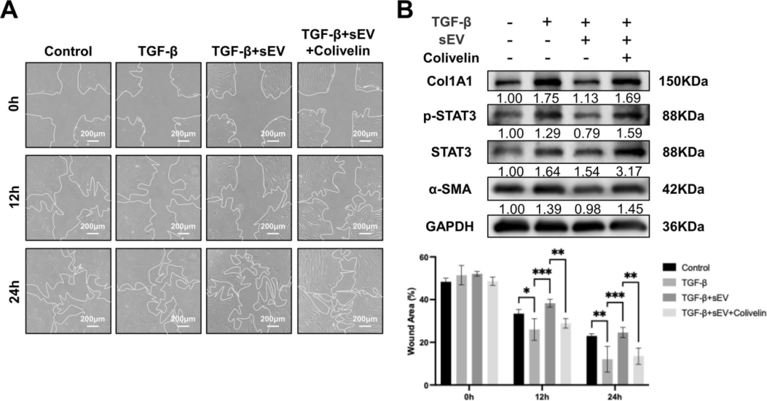 图6进一步验证了STAT3在sEV抗纤维化作用中的关键作用。