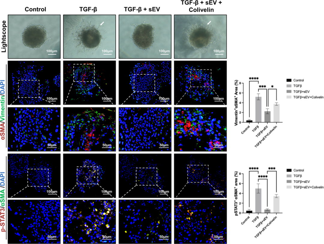图7展示了sEV在唾液腺类器官模型中通过STAT3抑制纤维化的效果。