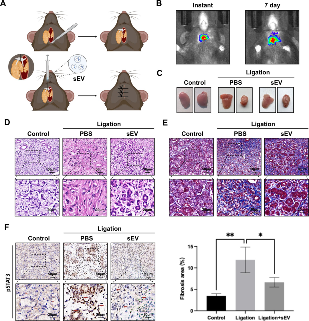 图8评估了sEV在小鼠Wharton’s导管结扎模型中对唾液腺纤维化的治疗效果。