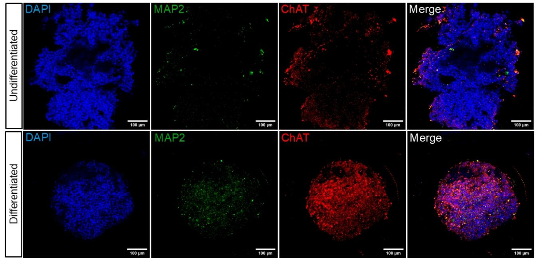 图 3:分化 SH-SY5Y 球体中 ChAT 和 MAP2 的表达