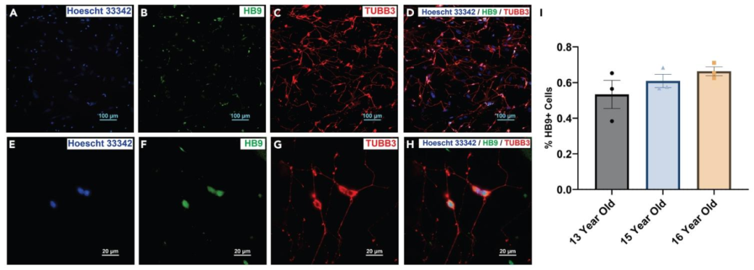图 3：犬诱导运动神经元早期标志物表达