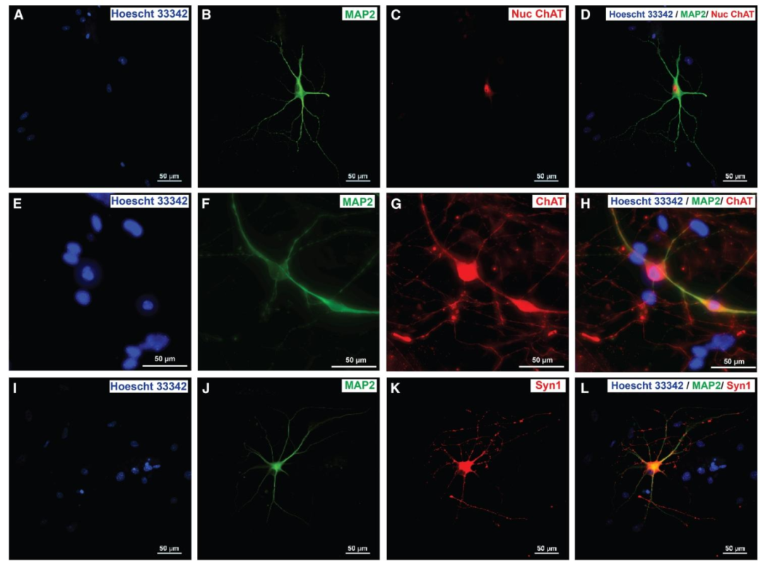 图 4：成熟犬诱导运动神经元的标志物表达
