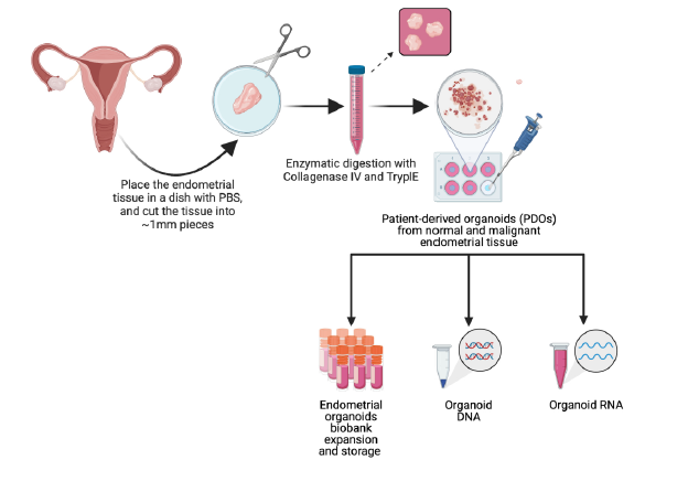 图1 患者来源样本中子宫内膜癌及正常类器官制备的示意图概述